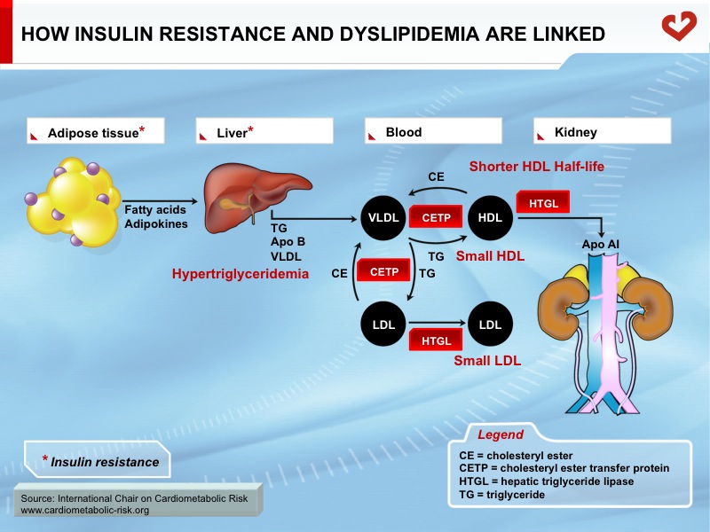 How insulin resistance and dyslipidemia are linked