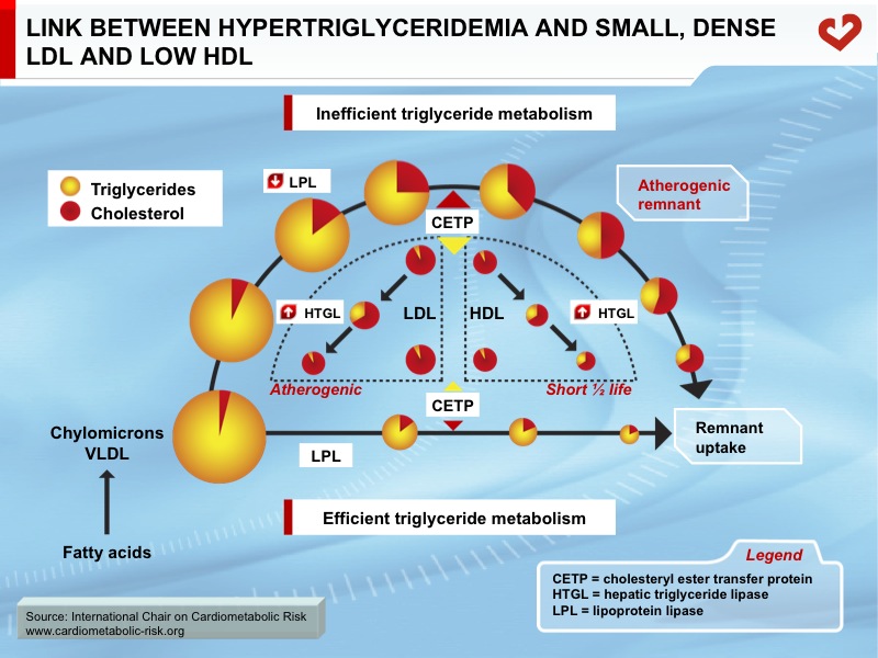 Link between hypertriglyceridemia and small, dense LDL and low HDL