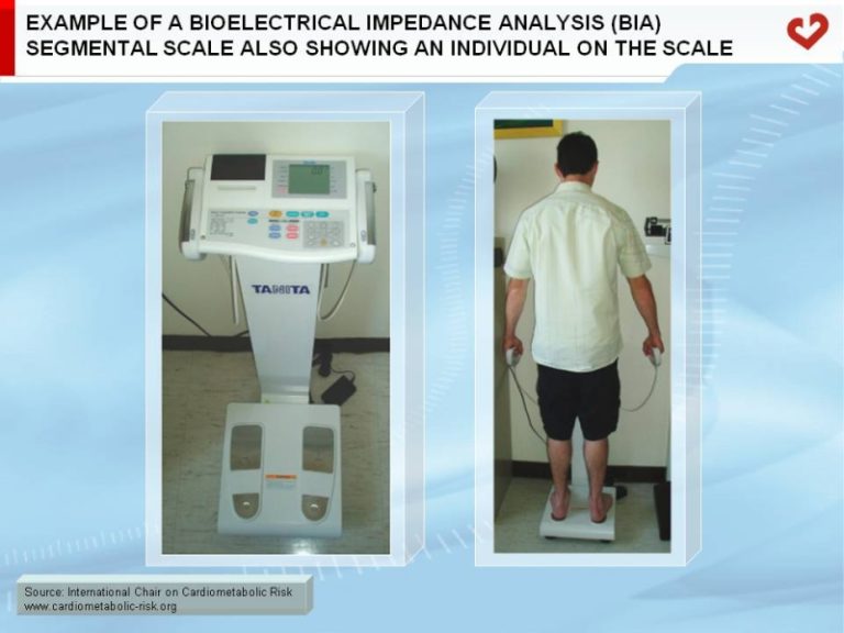 Example of a bioelectrical impedance analysis (BIA) segmental scale