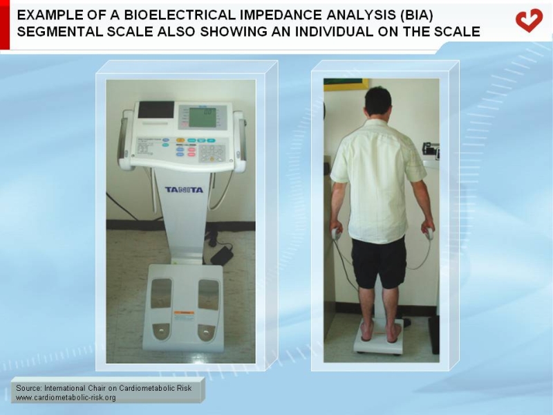 Example of a bioelectrical impedance analysis (BIA) segmental scale also showing an individual on the scale