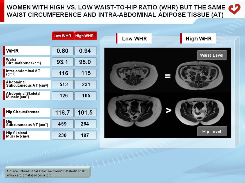 Women with high vs. low waist-to-hip ratio (WHR) but the same waist circumference and intra-abdominal adipose tissue (AT)