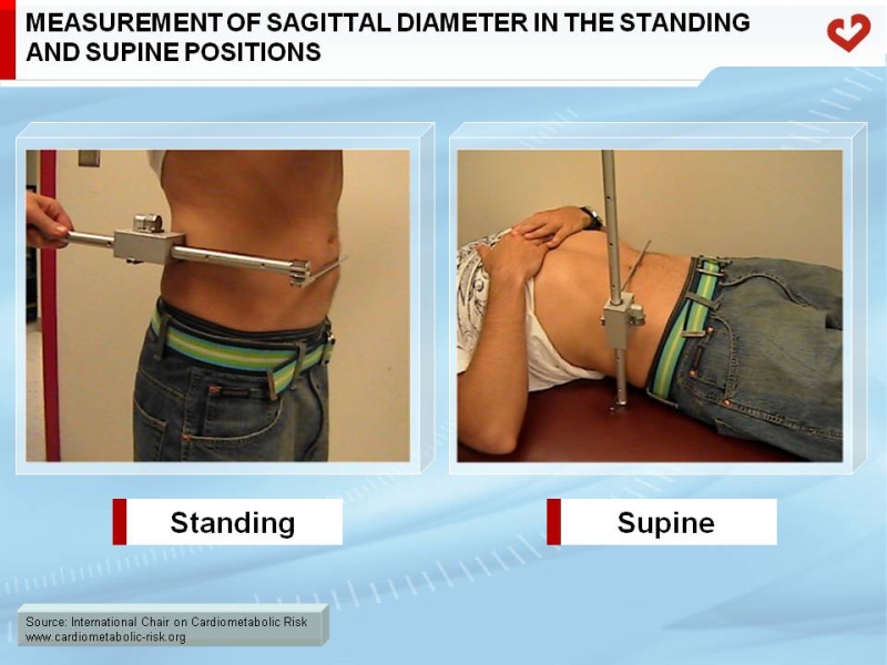 Measurement of sagittal diameter in the standing and supine positions