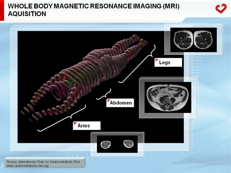 Whole body magnetic resonance imaging (MRI) acquisition