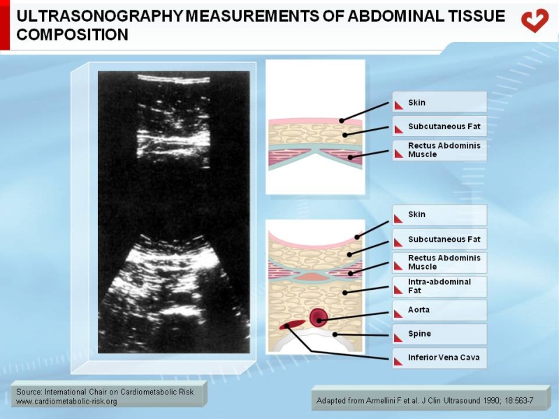 Ultrasonography measurements of abdominal tissue composition