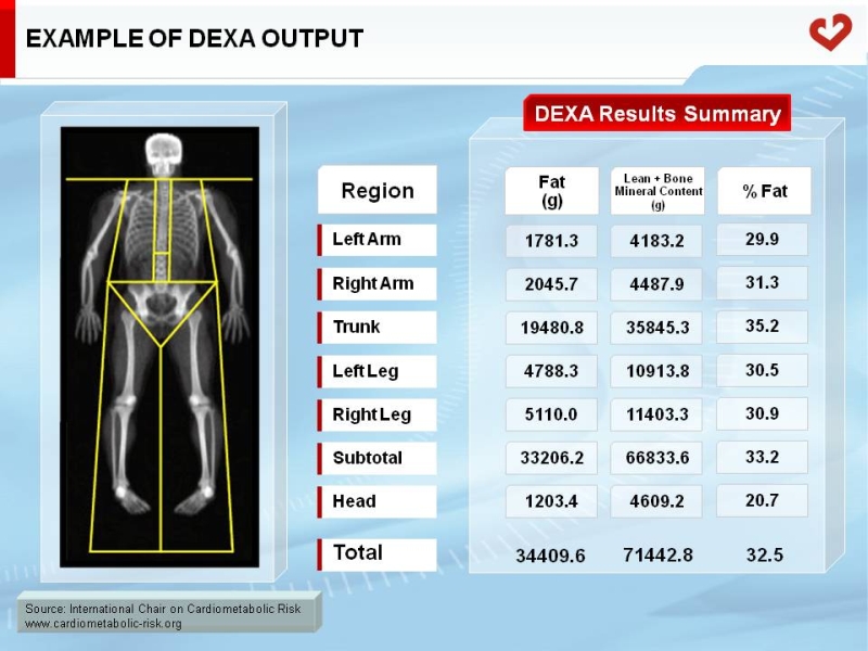 Example of DEXA output