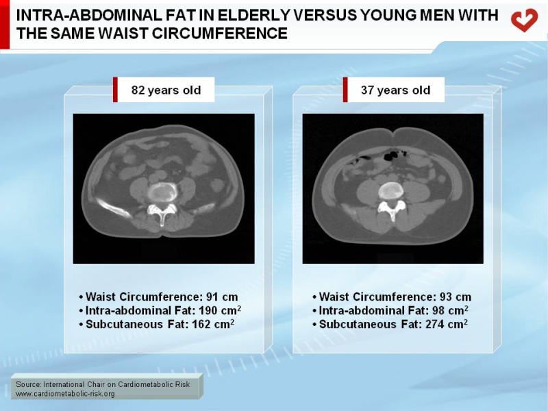 Intra-abdominal fat in elderly versus young men with the same waist circumference